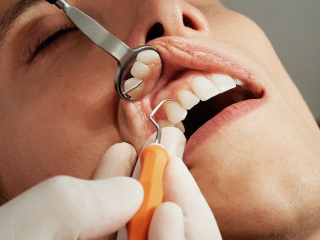What is Urgent and Emergency Dental Care?