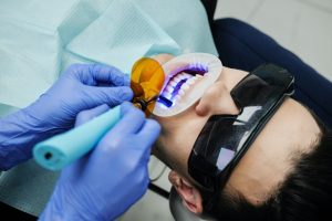 How Much Does a Cosmetic Dental Contouring Cost?