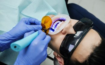 How Much Does a Cosmetic Dental Contouring Cost?